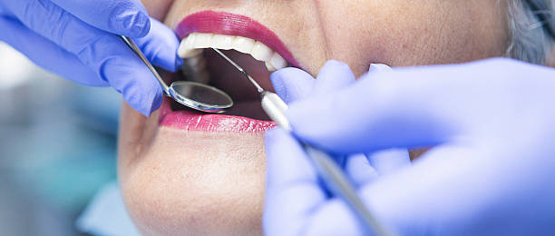 Best Urgent Care for Lost Fillings or Crowns in Liberty Hill, TX